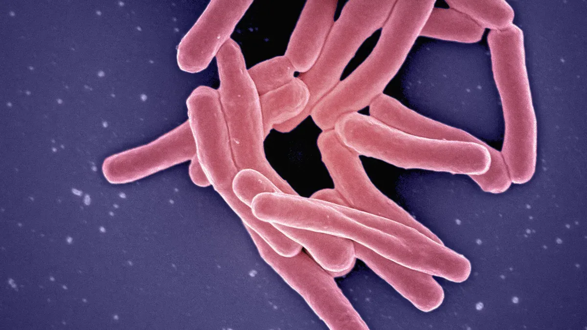 Bacterial Vaginosis Overview